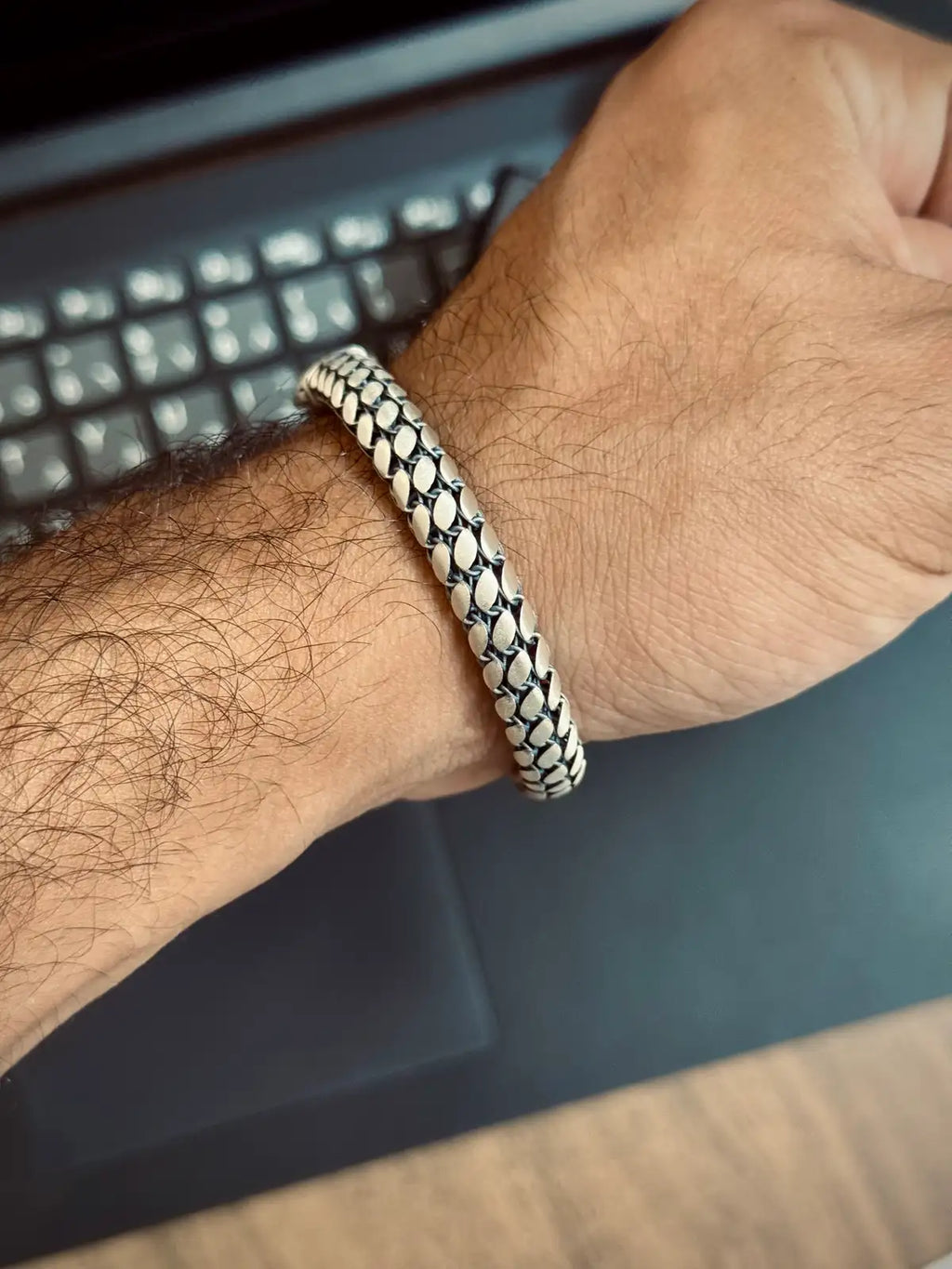 Skin Bracelet